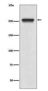 Anti-FASN/Fatty Acid Synthase Rabbit Monoclonal Antibody Boster Bio
