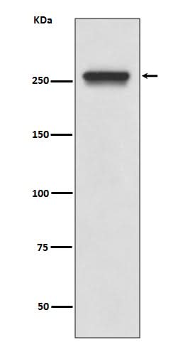 Anti-FASN/Fatty Acid Synthase Rabbit Monoclonal Antibody Boster Bio