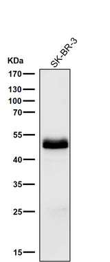Anti-PAX8 Rabbit Monoclonal Antibody Boster Bio
