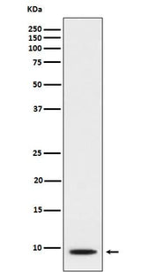 Anti-CXCL5 Rabbit Monoclonal Antibody Boster Bio