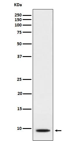 Anti-CXCL5 Rabbit Monoclonal Antibody Boster Bio