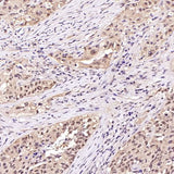 Anti-Hsp70 HSPA1A Rabbit Monoclonal Antibody Boster Bio