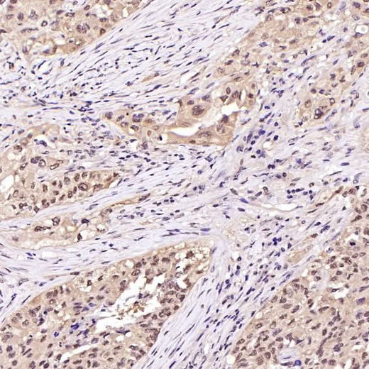 Anti-Hsp70 HSPA1A Rabbit Monoclonal Antibody Boster Bio