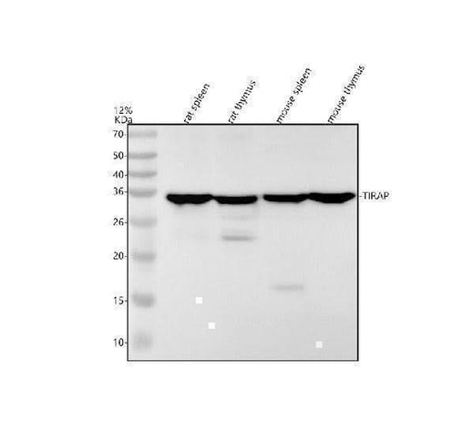 Anti-TIRAP Rabbit Monoclonal Antibody Boster Bio
