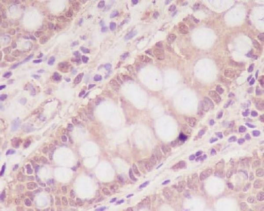 Anti-M6PR IGF2R Rabbit Monoclonal Antibody Boster Bio