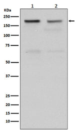 Anti-Topoisomerase II alpha TOP2A Rabbit Monoclonal Antibody Boster Bio