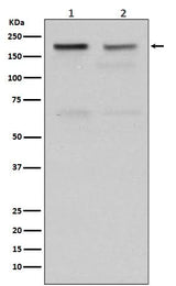 Anti-Topoisomerase II alpha TOP2A Rabbit Monoclonal Antibody Boster Bio