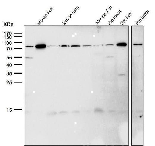 Anti-GRP78 BiP HSPA5 Rabbit Monoclonal Antibody Boster Bio