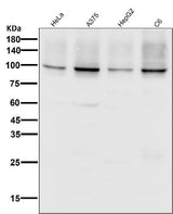 Anti-Sodium Potassium ATPase ATP1A1 Rabbit Monoclonal Antibody Boster Bio