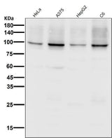 Anti-Sodium Potassium ATPase ATP1A1 Rabbit Monoclonal Antibody Boster Bio