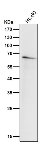 Anti-IRF5 Rabbit Monoclonal Antibody Boster Bio