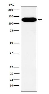 Anti-BCAR1 Rabbit Monoclonal Antibody Boster Bio