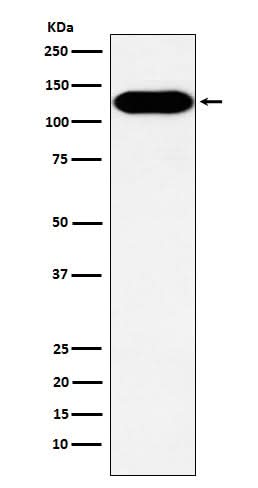 Anti-BCAR1 Rabbit Monoclonal Antibody Boster Bio