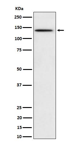 Anti-Phospho-BCAR1 (Y410) Rabbit Monoclonal Antibody Boster Bio