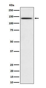 Anti-Phospho-BCAR1 (Y410) Rabbit Monoclonal Antibody Boster Bio