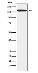 Anti-BAT3 Rabbit Monoclonal Antibody Boster Bio