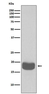 Anti-eIF4EBP1/4Ebp1 Rabbit Monoclonal Antibody Boster Bio