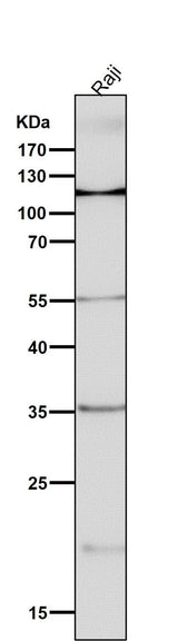 Anti-NFAT1 NFATC2 Rabbit Monoclonal Antibody Boster Bio