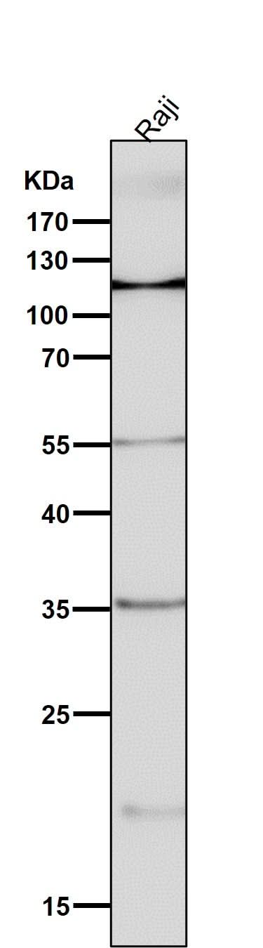 Anti-NFAT1 NFATC2 Rabbit Monoclonal Antibody Boster Bio