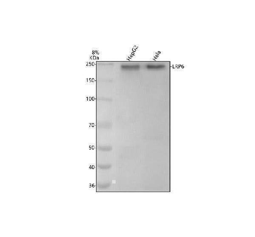 Anti-LRP6 Rabbit Monoclonal Antibody Boster Bio