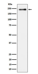 Anti-Phospho-LRP6 (S1490) Rabbit Monoclonal Antibody Boster Bio