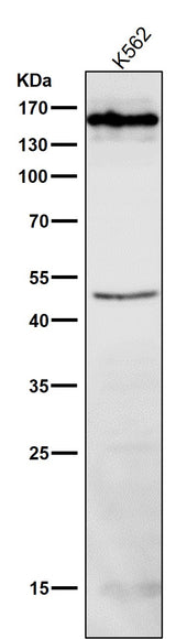 Anti-HDAC4/Histone Deacetylase 4 Rabbit Monoclonal Antibody Boster Bio