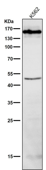 Anti-HDAC4/Histone Deacetylase 4 Rabbit Monoclonal Antibody Boster Bio