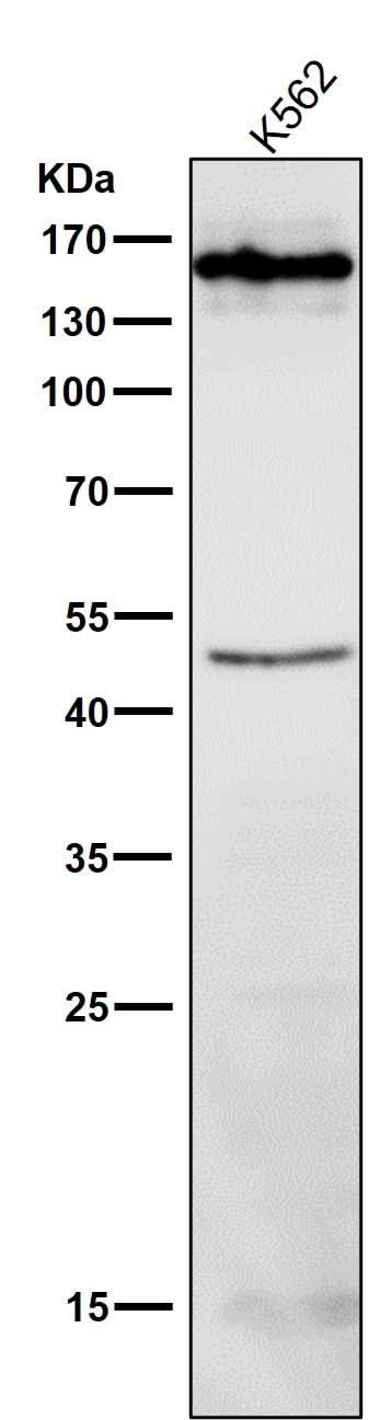 Anti-HDAC4/Histone Deacetylase 4 Rabbit Monoclonal Antibody Boster Bio