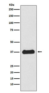 Anti-Follistatin Rabbit Monoclonal Antibody Boster Bio