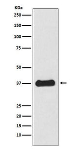 Anti-Follistatin Rabbit Monoclonal Antibody Boster Bio