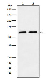 Anti-CLPX Rabbit Monoclonal Antibody Boster Bio