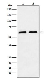 Anti-CLPX Rabbit Monoclonal Antibody Boster Bio