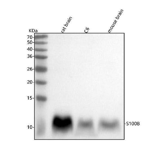 Anti-S100B/S100 Beta Rabbit Monoclonal Antibody Boster Bio