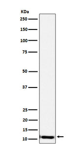 Anti-SPINK1 Rabbit Monoclonal Antibody Boster Bio