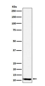 Anti-SPINK1 Rabbit Monoclonal Antibody Boster Bio