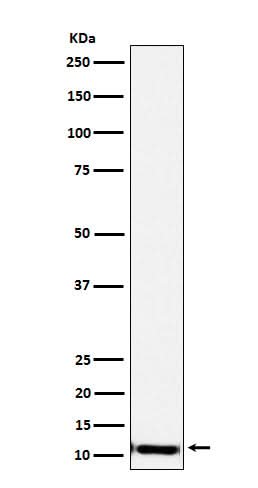 Anti-SPINK1 Rabbit Monoclonal Antibody Boster Bio