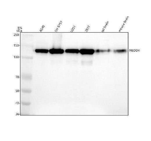 Anti-NEDD4 Rabbit Monoclonal Antibody Boster Bio