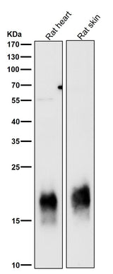 Anti-Caveolin-3 CAV3 Rabbit Monoclonal Antibody Boster Bio