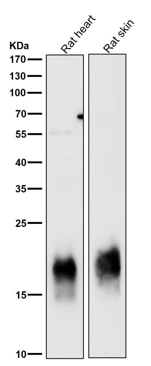 Anti-Caveolin-3 CAV3 Rabbit Monoclonal Antibody Boster Bio