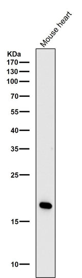 Anti-Caveolin-3 Rabbit Monoclonal Antibody Boster Bio
