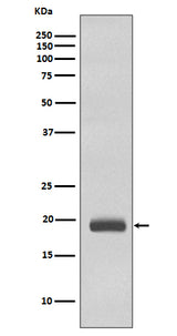 Anti-Caveolin-3 CAV3 Rabbit Monoclonal Antibody Boster Bio