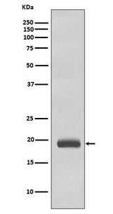 Anti-Caveolin-3 CAV3 Rabbit Monoclonal Antibody Boster Bio