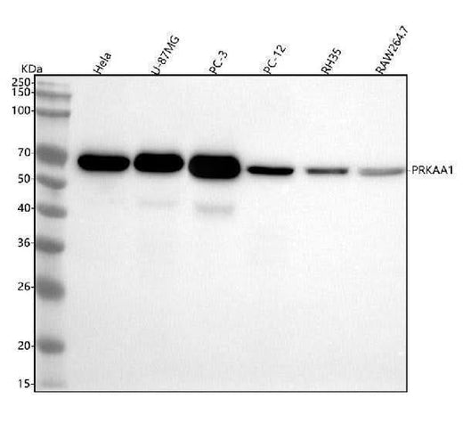 Anti-AMPK alpha 1 PRKAA1 Rabbit Monoclonal Antibody Boster Bio