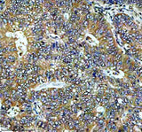 Anti-MEK2 MAP2K2 Rabbit Monoclonal Antibody Boster Bio