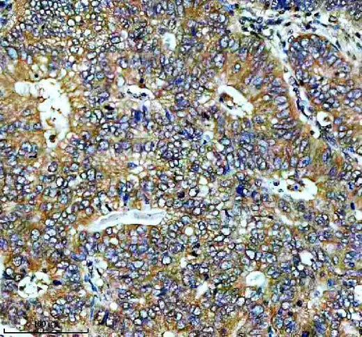 Anti-MEK2 MAP2K2 Rabbit Monoclonal Antibody Boster Bio