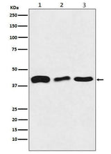 Anti-TDP43 Rabbit Monoclonal Antibody Boster Bio