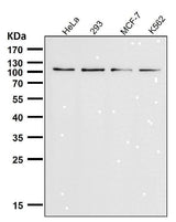 Anti-TRPM8 Monoclonal Antibody Boster Bio