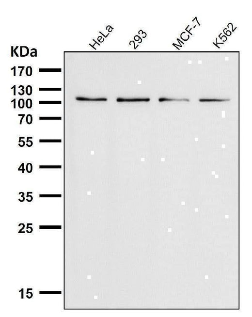 Anti-TRPM8 Monoclonal Antibody Boster Bio
