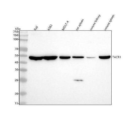 Anti-Neurokinin 1 Receptor Monoclonal Antibody Boster Bio