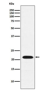 Anti-CBFb Rabbit Monoclonal Antibody Boster Bio